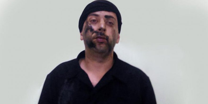 Azerbaycan ile Ermenistan gerilimi tırmanabilir