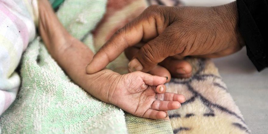 Yemenli aileler 2 günde 1 öğün yemekle yaşam mücadelesi veriyor