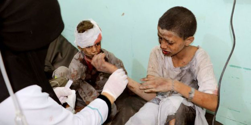 Yemen'deki savaş ve vahşet bilerek unutturuluyor