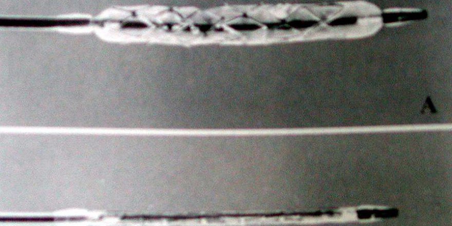 Saç teli kadar bir stent ile kalp hastalığına müdahale