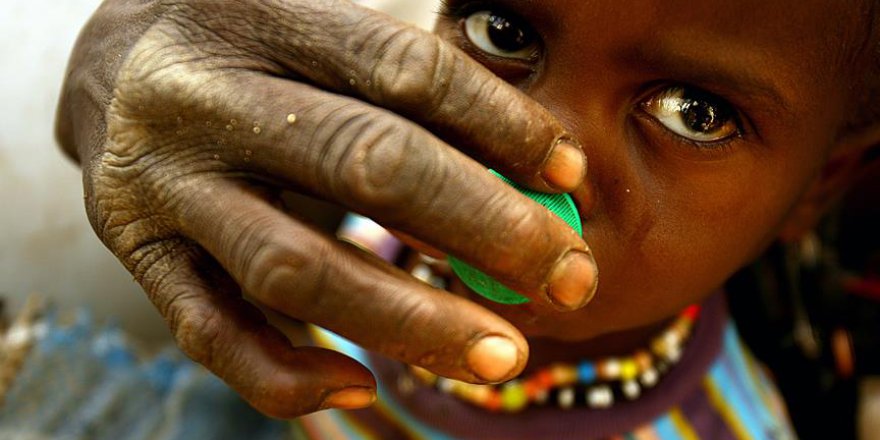 20 bin çocuk ölümün eşiğinde