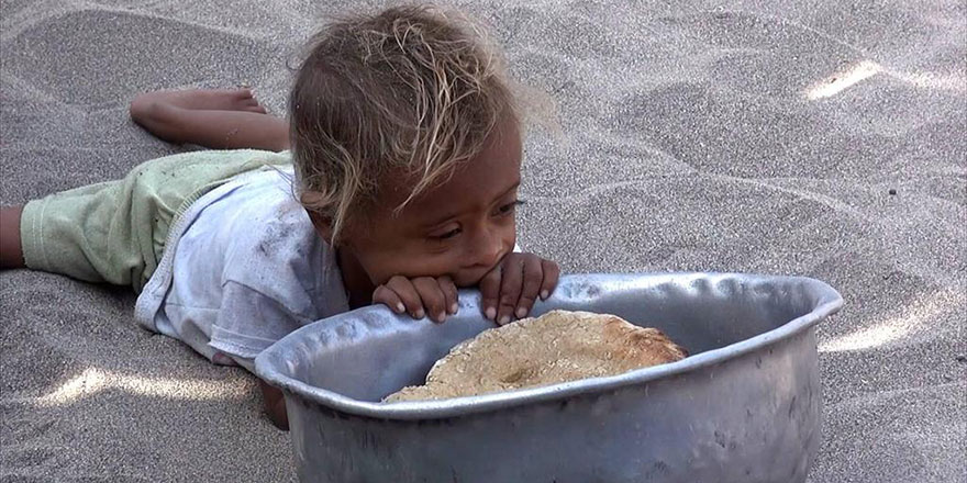 Milyonlarca Yemenli geceleri aç uyumak zorunda kalıyor