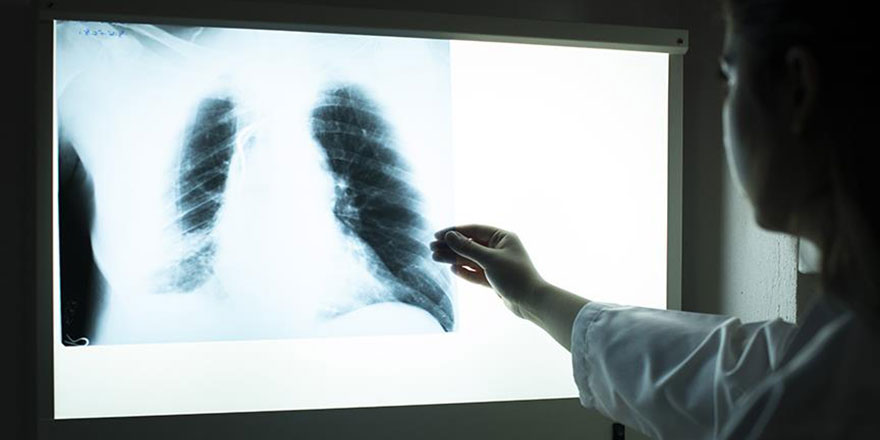 Radyolojide yapay zeka dönemi