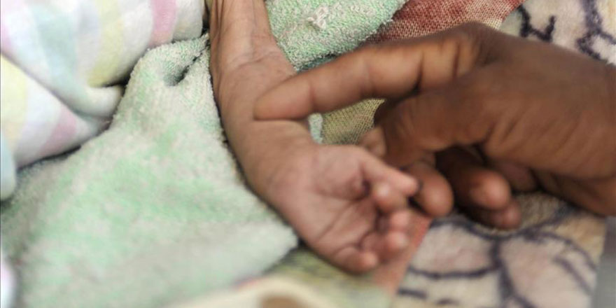 Yemen'de 85 bin çocuk açlıktan öldü