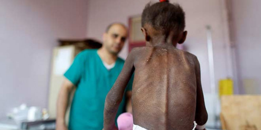 UNICEF'ten Yemen'de 2,8 milyon çocuğa aşı kampanyası