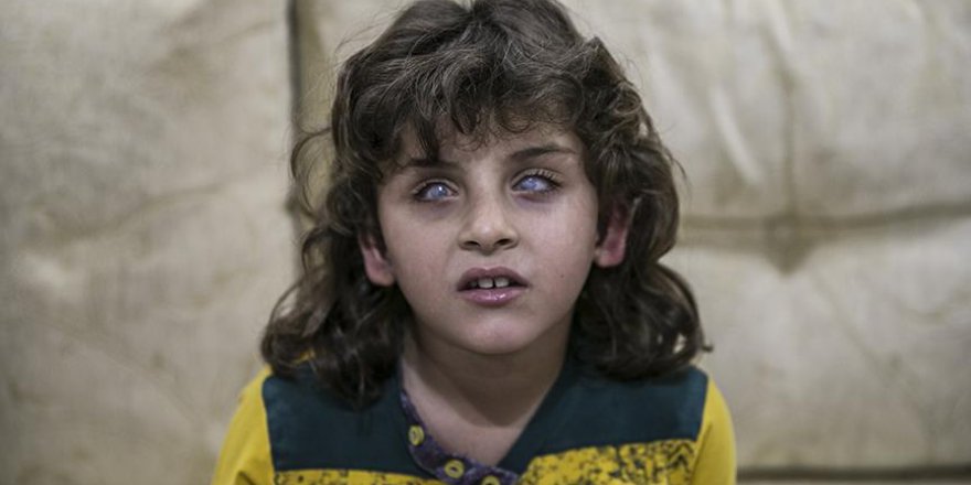 Esed'in saldırılarında gözlerini kaybeden 8 yaşındaki kız umut arıyor