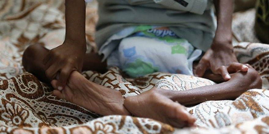 Yemen'in 'unutulan iç savaşı' 5'inci yılına girdi