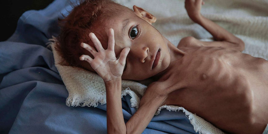 Türkiye'deki 90 bin camide Yemen için yardım istenecek