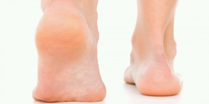 Topuk ağrısı her 3 kişiden birinde var