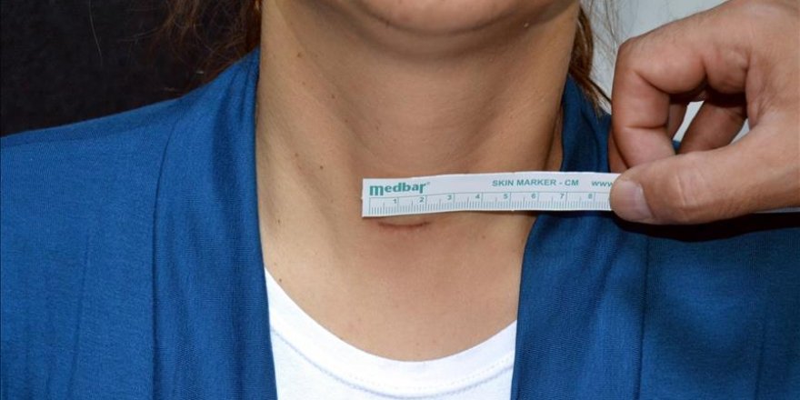 'Her 3 kişiden birinin tiroidinde nodül var'