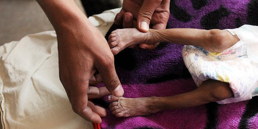 Yemen'de 6 binden fazla çocuk ölü veya yaralı