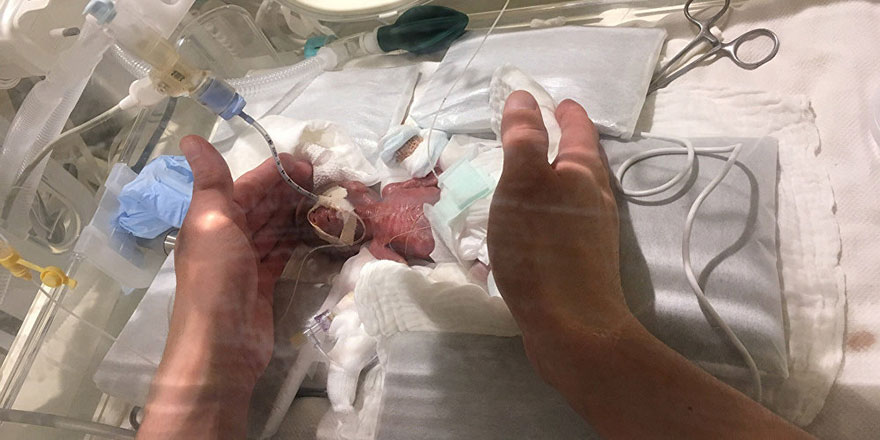 Subhanallah: Japonya'da doğan bebek dünyanın en küçüğü
