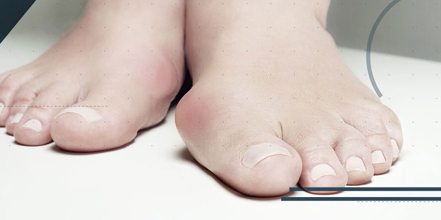 Ayaktaki ağrı birçok rahatsızlığı işaret ediyor olabiliyor