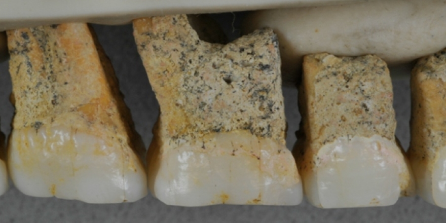 'Filipinler'de bulunan fosiller yeni bir insan türüne ait'