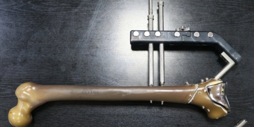 "Yerli çivi" kırıkları daha erken iyileştirecek