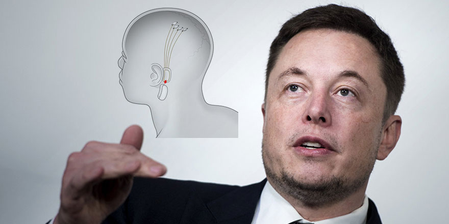 Akıllı saatler dünün, neuralink geleceğin teknolojisi