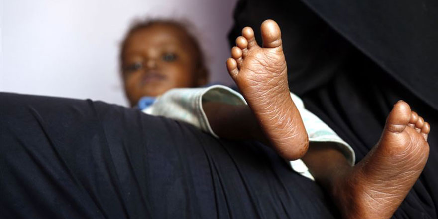 Yemen'deki savaşın en ağır faturasını çocuklar ödüyor