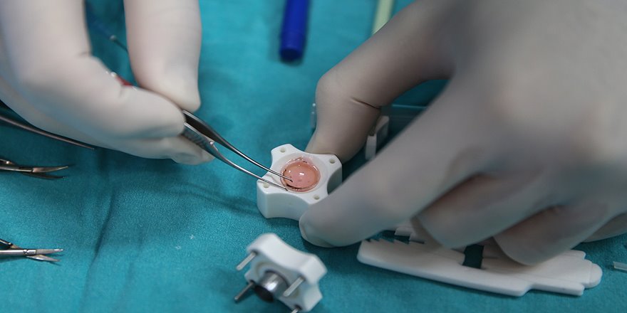 Görme engelli bir adam, yapay kornea sayesinde tekrar görmeye başladı