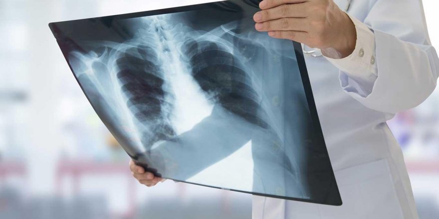 'Hasar artmadan sigarayı bırakın'