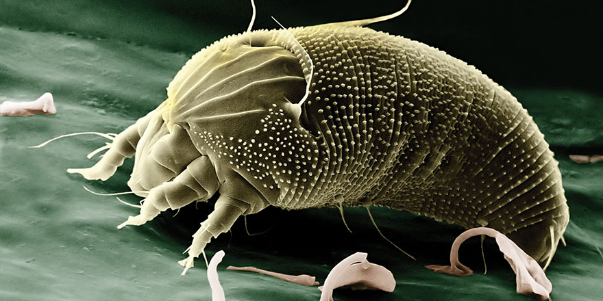 5 yıl kullanılan bir yatakta 10 milyon mite yaşıyor