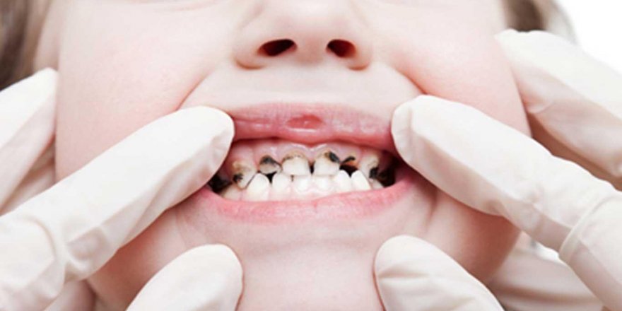 Pandemide ‘şuursuz diş sıkma’ oranı arttı