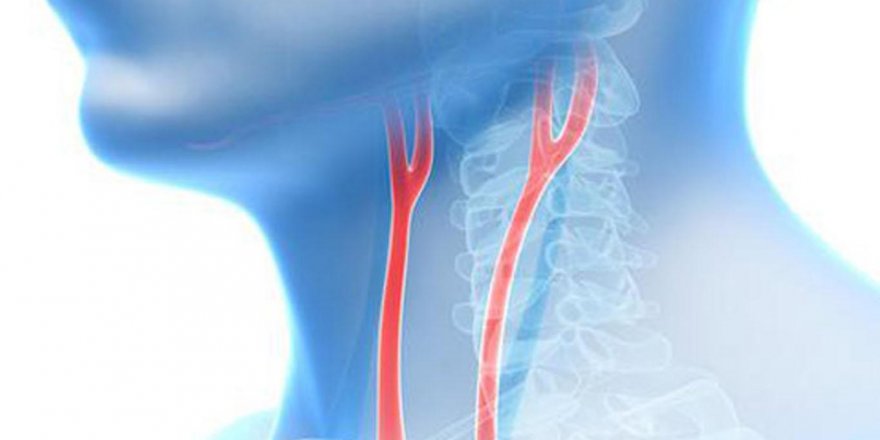 Sizde de bu belirtiler varsa, Rozasea olabilirsiniz