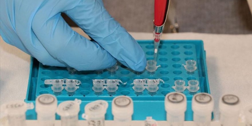 Adana'dan yurt dışına kanser testi hizmeti