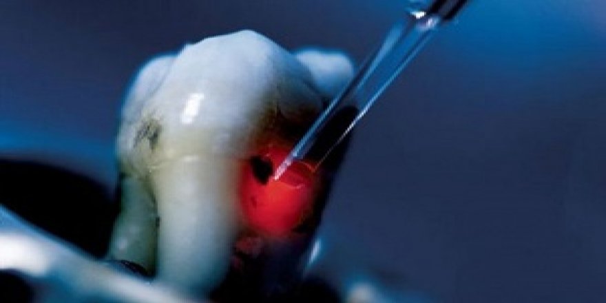 “Fazla kilonuzun nedeni çürük diş olabilir”