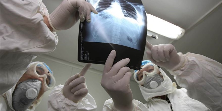 Çin'de SARS benzeri 'gizemli virüs'ten ölenlerin sayısı 3'e çıktı