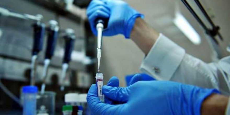 İzmir'de domuz gribini beş dakikada tespit eden cihaz yapıldı