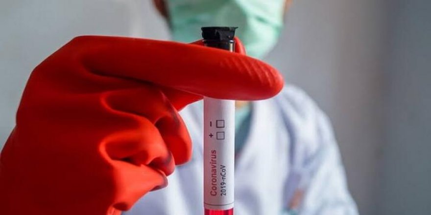 Corona virüsü aşısı var mı?