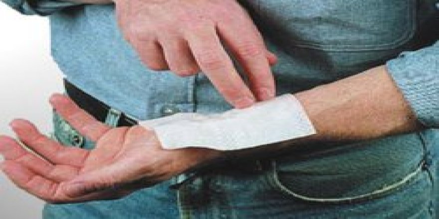 “Kar yanığı cildinizde kalıcı hasar bırakabilir”