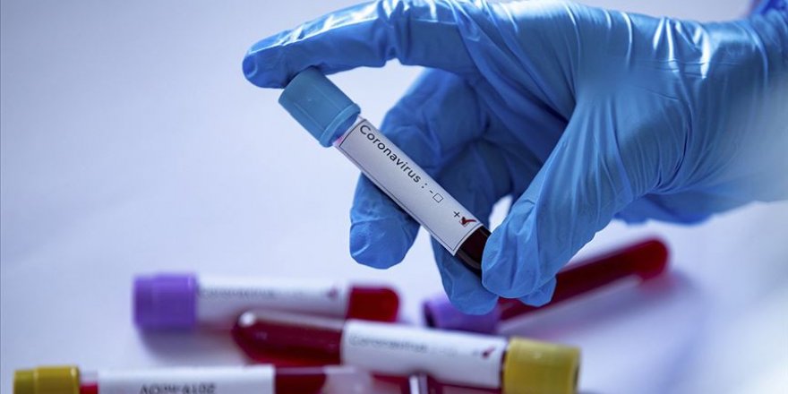 Rusya, İran'a koronavirüs tespiti için 50 bin kit gönderiyor