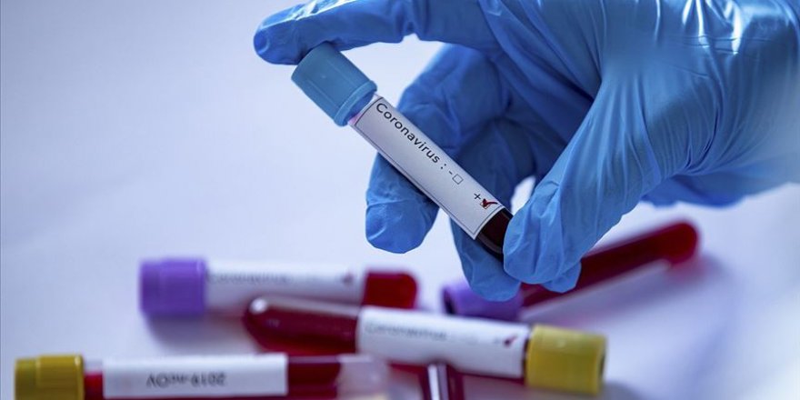 Dünya genelinde koronavirüs tanısı konan kişi sayısı 150 bini geçti