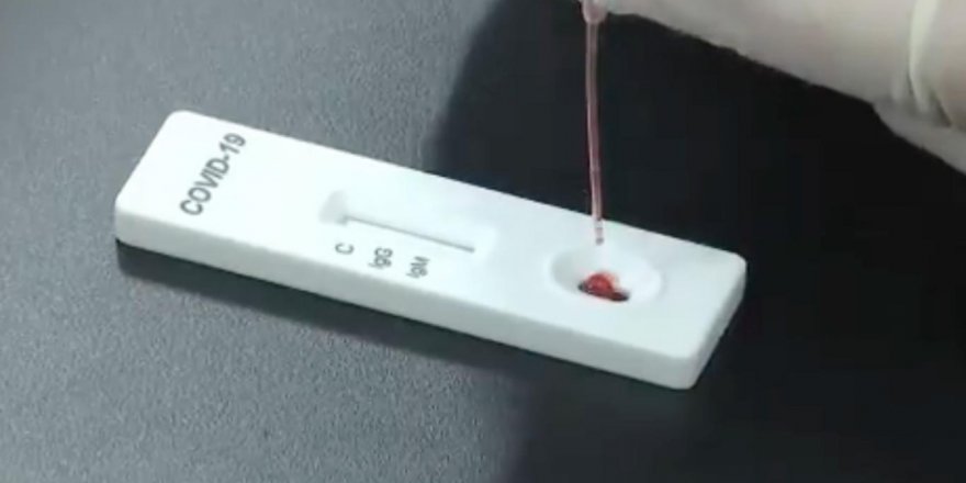 Çin'de 15 dakikada sonuç veren Corona virüs testi geliştirildi