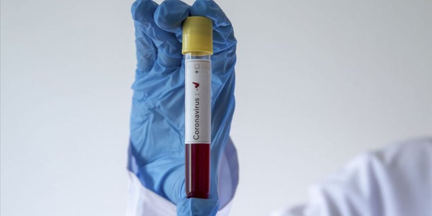 G-7 ülkelerinden Kovid-19'a karşı iş birliği vurgusu