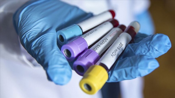 G-7 ülkelerinden Kovid-19'a karşı iş birliği vurgusu