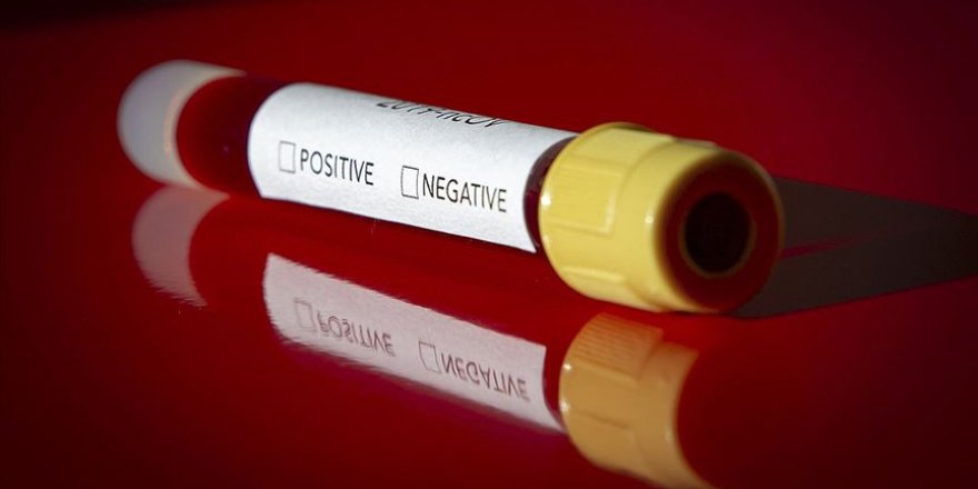 Koronavirüs tanısını 90 dakikada koyabilen cihaz geliştirildi