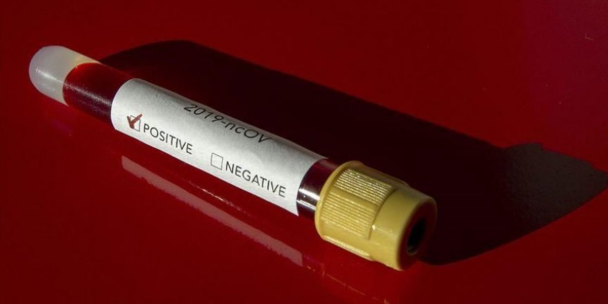 İsrail'de Kovid-19 yasağına rağmen Ultra-Ortodokslara ait dini okullarda eğitim devam ediyor