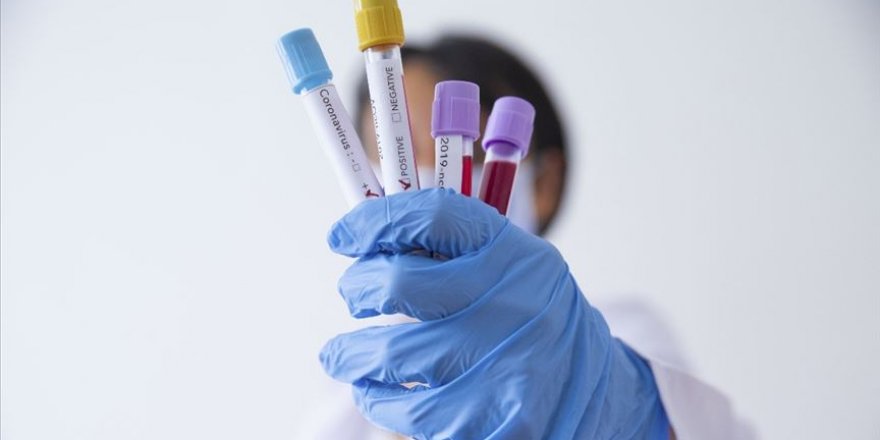 Bilim insanlarına göre Kovid-19 insan yapımı değil