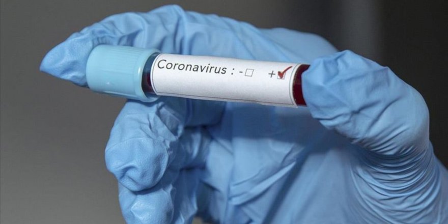 İngiltere, "oyunun kurallarını değiştirecek" Kovid-19 testi geliştiriyor