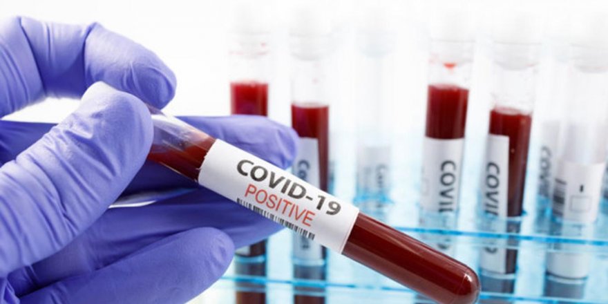 İtalya'da Kovid-19'dan ölenlerin sayısı 6 bini geçti