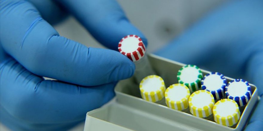 Türk biyoteknoloji firması koronavirüs tanı kiti geliştirdi