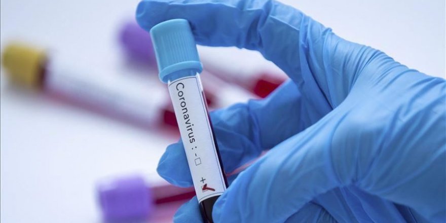 Dünya genelinde Kovid-19 bulaşan kişi sayısı 246 bini geçti