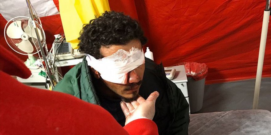 Yunanistan'ın attığı plastik mermi sığınmacıyı gözünden etti