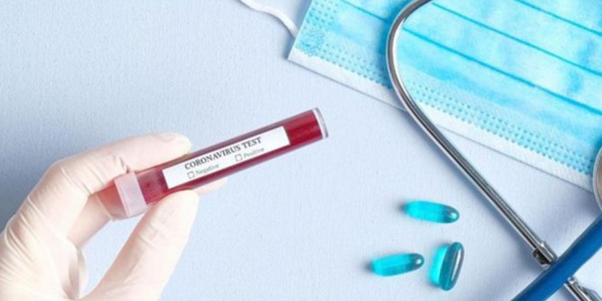 1500 girişimciden koronavirüse 150 çözüm önerisi