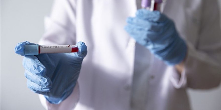 Türkiye Kolombiya’ya 26 bin Kovid-19 tanı testi gönderdi