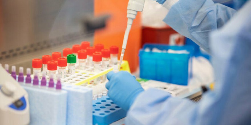 Koronavirüs test sayılarında 20 gün içerisinde büyük artış yaşanacak