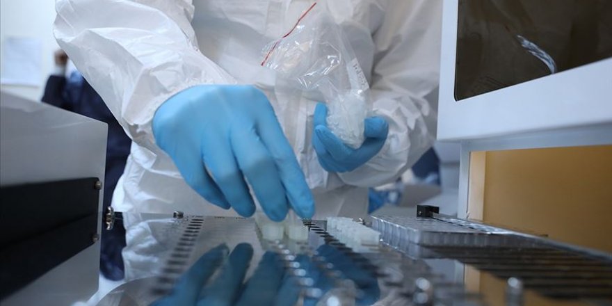 Üsküdar Üniversitesi Kovid-19'u belirleyecek test kiti üzerinde çalışıyor