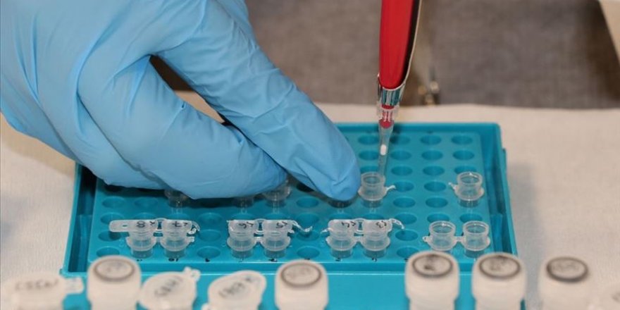 Azerbaycan, ilk Kovid-19 testlerini Türkiye'nin aracılığıyla elde etti